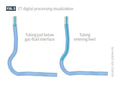 CT digital processing visualization (Fig. 2) CT digital processing visualization (Fig. 2)
